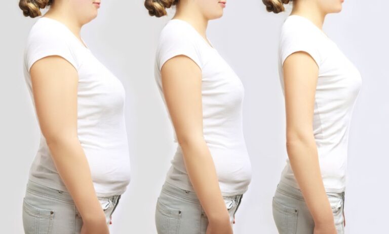 Search for “top-rated weight loss surgery clinics near me” today and book a consultation with a specialist. The future you want might just be one click away.