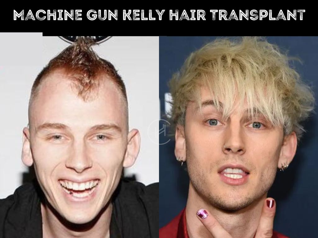 Machine Gun Kelly