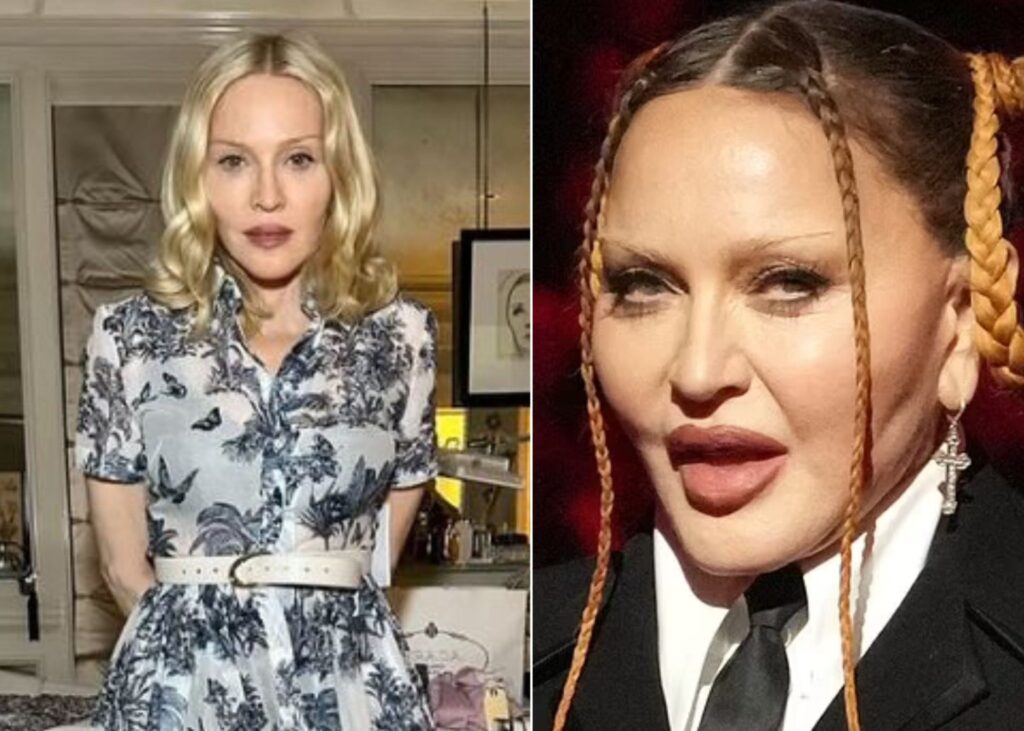 Madonna Madonna — The Queen of Pop or Queen of Fillers